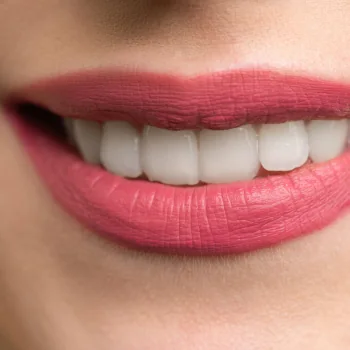 Sorriso com estética labial natural