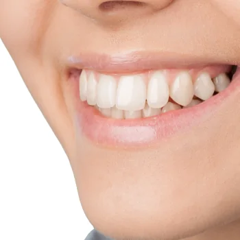 Sorriso claro e alinhado