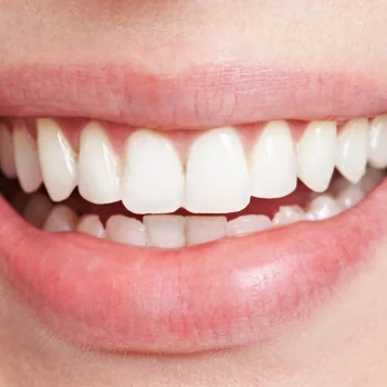 Close de sorriso natural